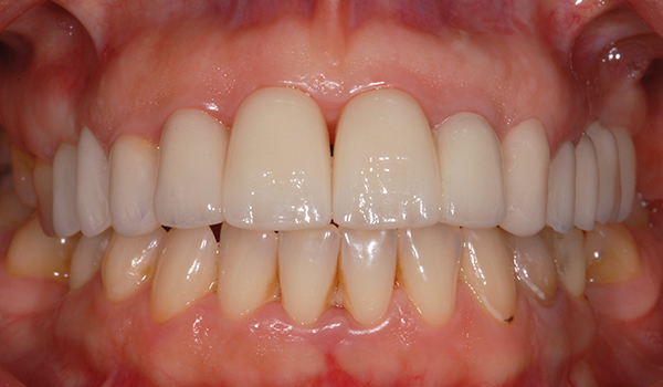 Case 04 after treatment
