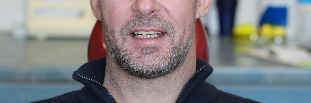 Portrait after smile restoration treatment