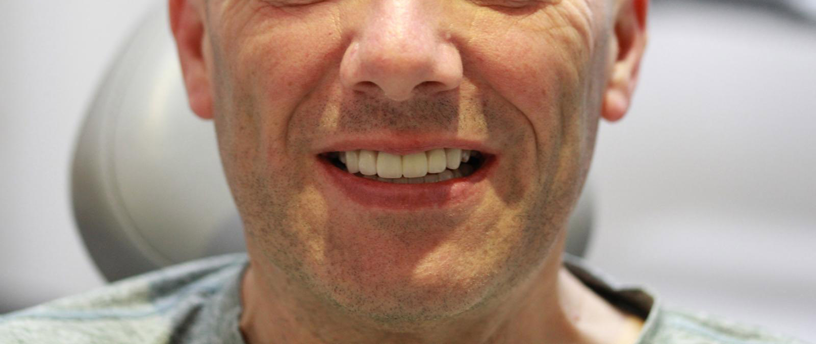 After anterior zirconia smile restoration portrait