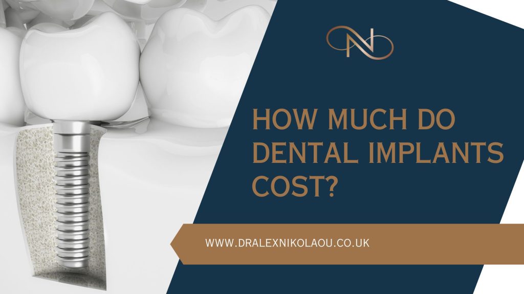 How Much Do Implants Cost?